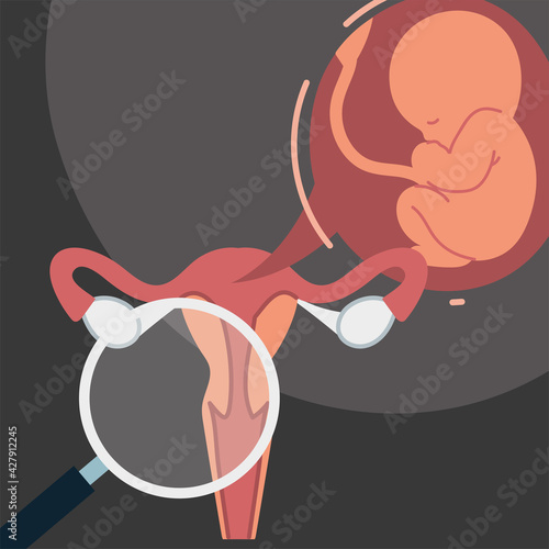 analysis uterus magnifier