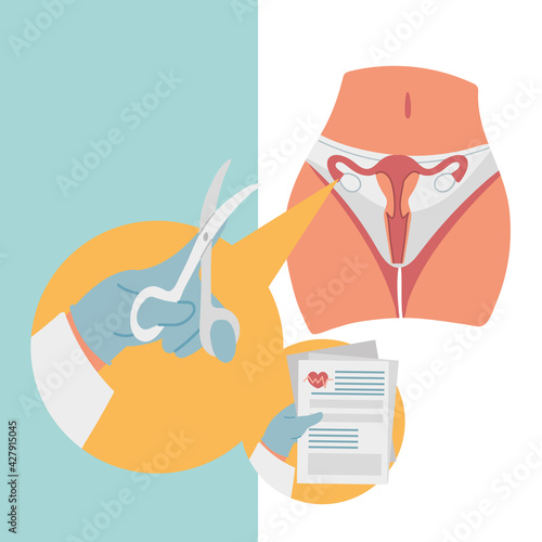 gynecological surgery uterus