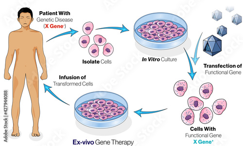 illustration of Ex vivo gene therapy in humans. photo