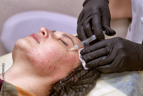 Doctor cosmetologist makes an injection into a woman's face. Biorevitalization procedure