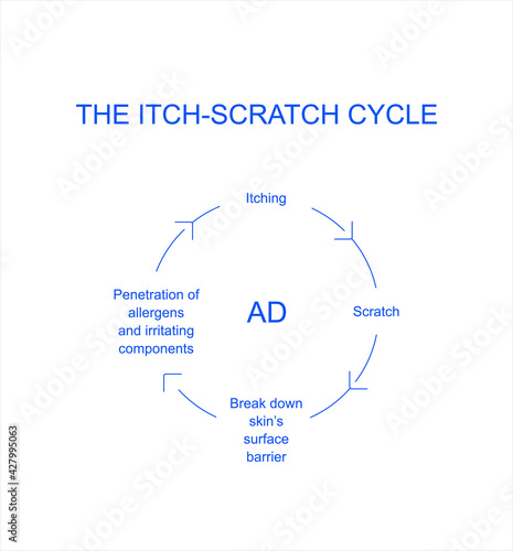 Atopic dermatitis itch-scratch cycle conditions. Eczema-prone skin. Infographics vector illustration.