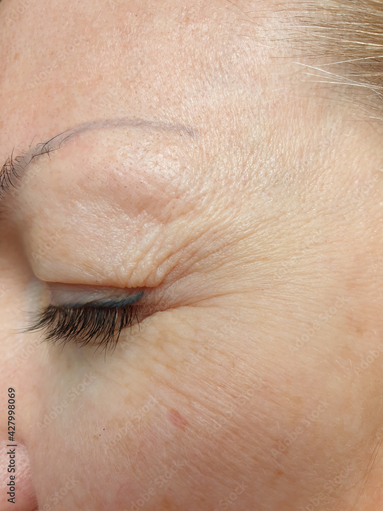 Obraz premium woman eyes wrinkles, aging skin