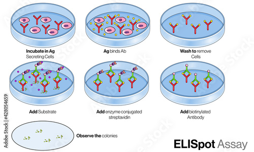 Protocol of Steps involved in Eli Spot assay, Principle of Eli spot test illustration. 