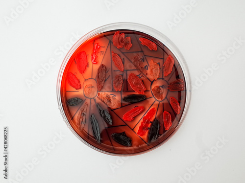 grwoth of different bacterial species on congo red agar plate to detect the ability of  the bacteria to produce biofilm photo