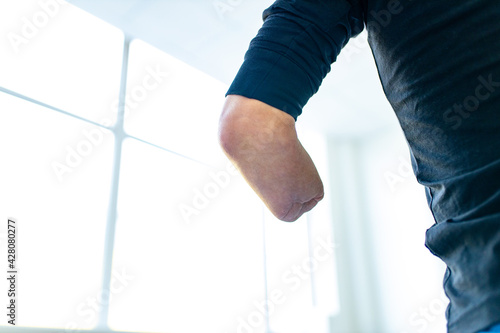 close up amputee hands of young man indoors doing warm up in gym