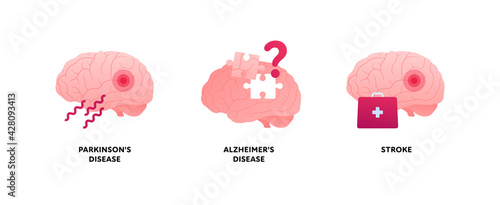 Brain disease concept. Vector flat illustration set. Parkinson, alzheimer and stroke attack illness icon. Health care neurology medical sign. Design element.