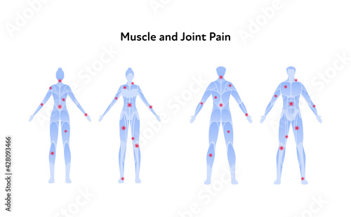 Muscle and joint pain infographic. Vector flat illustration set. Man and woman standing blue skinless silhouette with red ache dot. Front and back view. Design element for health care.