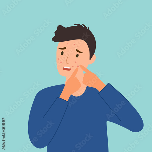 Man pop pimple on face in flat design. Men acne skin problem.