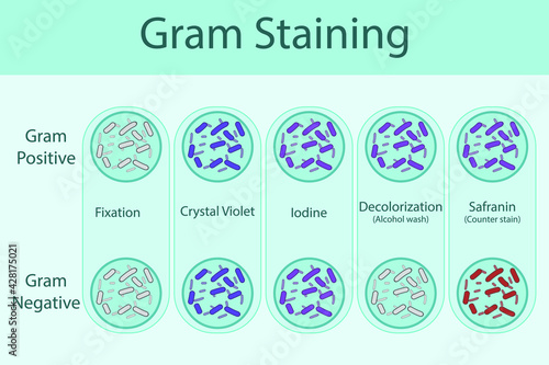 Diagram showing gram staining technique steps - microbiology labolatory using Crystal violet and Safranin