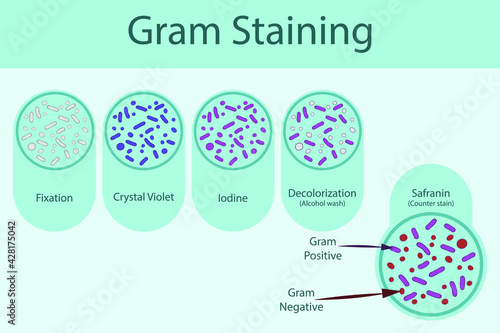Diagram showing gram staining technique steps - microbiology labolatory using Crystal violet and Safranin