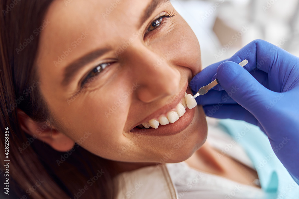 Male doctor put client artificial teeth to true ones. Whitening procedure or tooth replacing Male doctor put client artificial teeth to true ones. Whitening procedure or tooth replacing