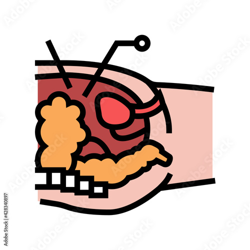 operation process bariatric color icon vector. operation process bariatric sign. isolated symbol illustration