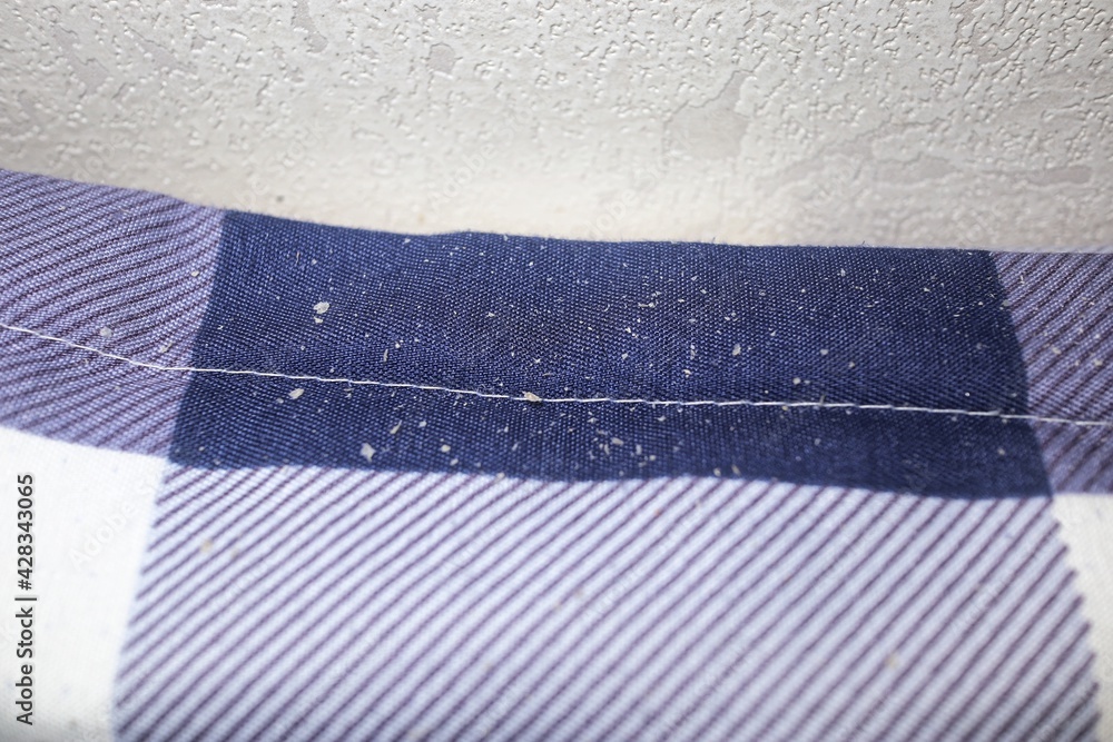dandruff dandruff