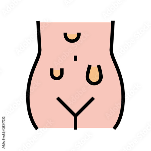 abdominal hernias disease color icon vector. abdominal hernias disease sign. isolated symbol illustration