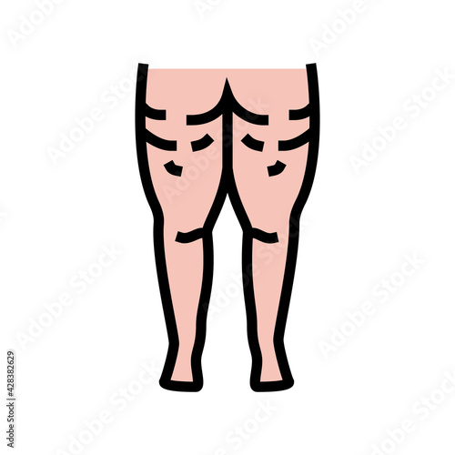 cellulite problem color icon vector. cellulite problem sign. isolated symbol illustration
