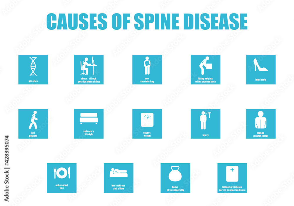 Causes of the spine disease. A set of icons on the topic of posture disorders. Medical infographics on the topic of scoliosis, lordosis, kyphosis Causes of the spine disease. A set of icons on the topic of posture disorders. Medical infographics on the topic of scoliosis, lordosis, kyphosis