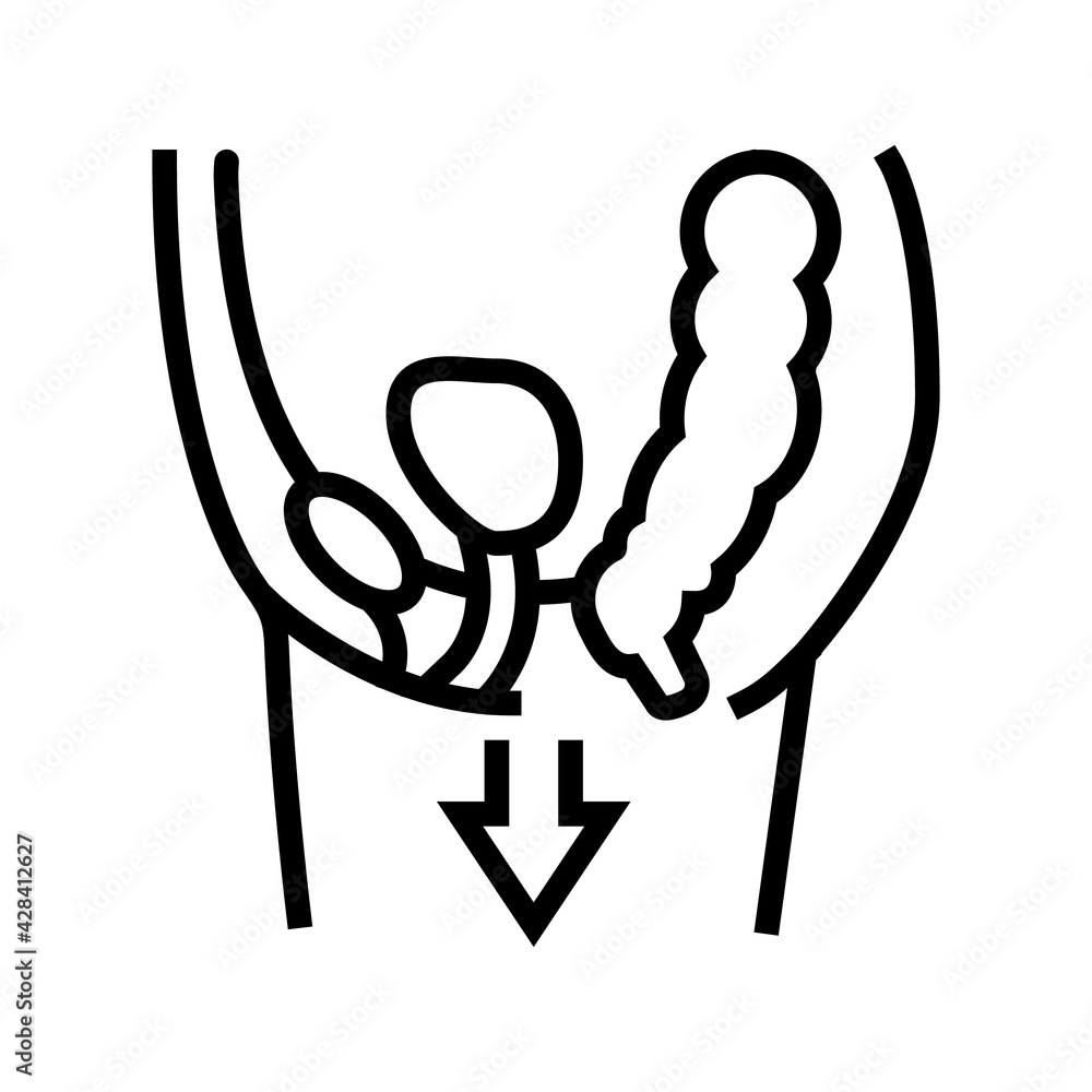 organ prolapse disease line icon vector. organ prolapse disease sign ...