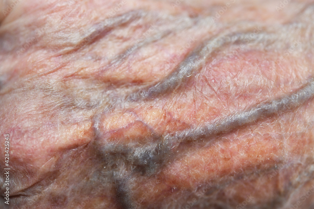 Fototapeta premium Close up of skin of hand of old 90 year old woman grandmother.