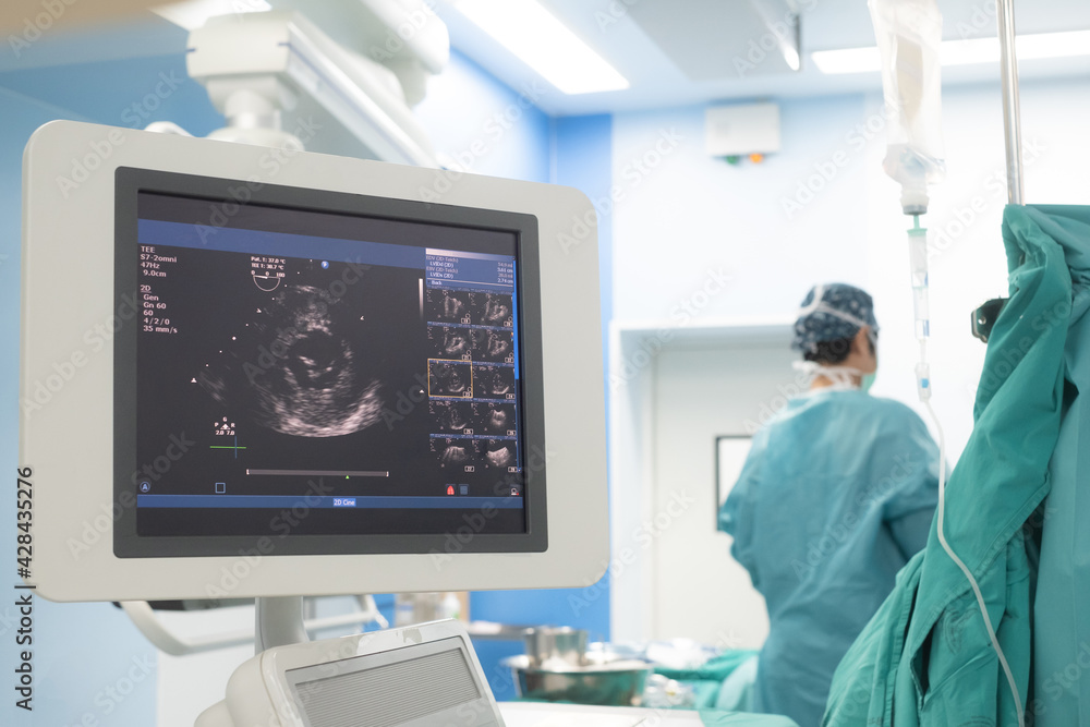 Doctor is examining heart's patient by echocardiogram for diagnosis disease or explain symptom. Medical exam , ultrasound. Medical equipment. Doctor is examining heart's patient by echocardiogram for diagnosis disease or explain symptom. Medical exam , ultrasound. Medical equipment.