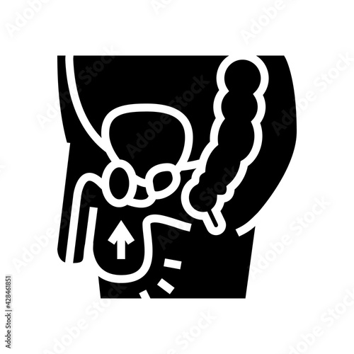 cryptorchidism disease line icon vector. cryptorchidism disease sign. isolated contour symbol black illustration