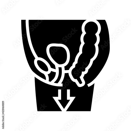 organ prolapse disease line icon vector. organ prolapse disease sign. isolated contour symbol black illustration