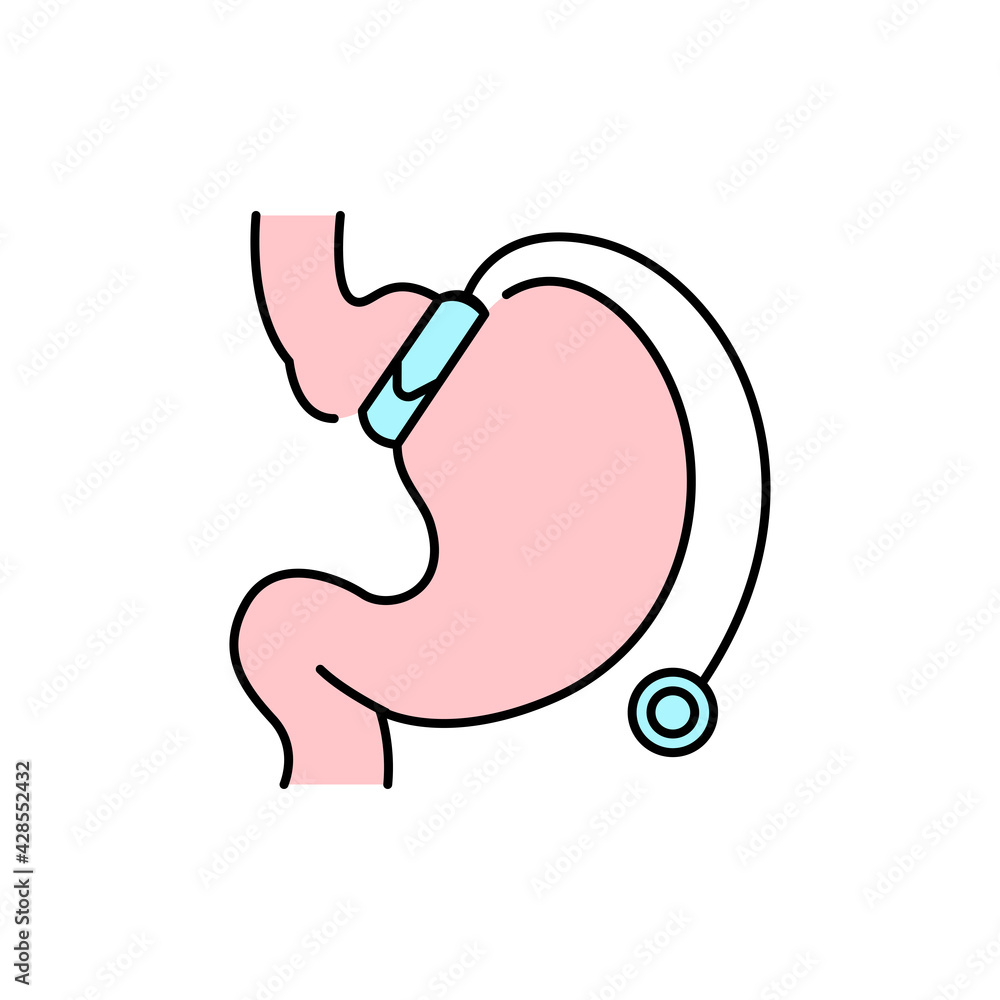 Gastric lap-band olor line icon. Pictogram for web page, mobile app, promo. Gastric lap-band olor line icon. Pictogram for web page, mobile app, promo.