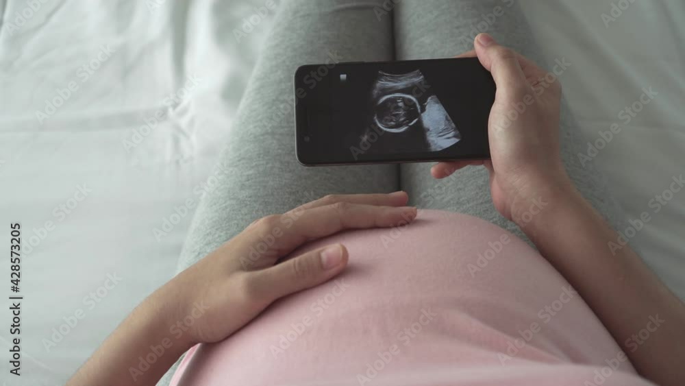 Happy Asian Pregnant woman looking ultrasound image on smartphone while touching her belly. Baby development, Concept of pregnancy, Maternity prenatal care. Mom with a new life Happy Asian Pregnant woman looking ultrasound image on smartphone while touching her belly. Baby development, Concept of pregnancy, Maternity prenatal care. Mom with a new life