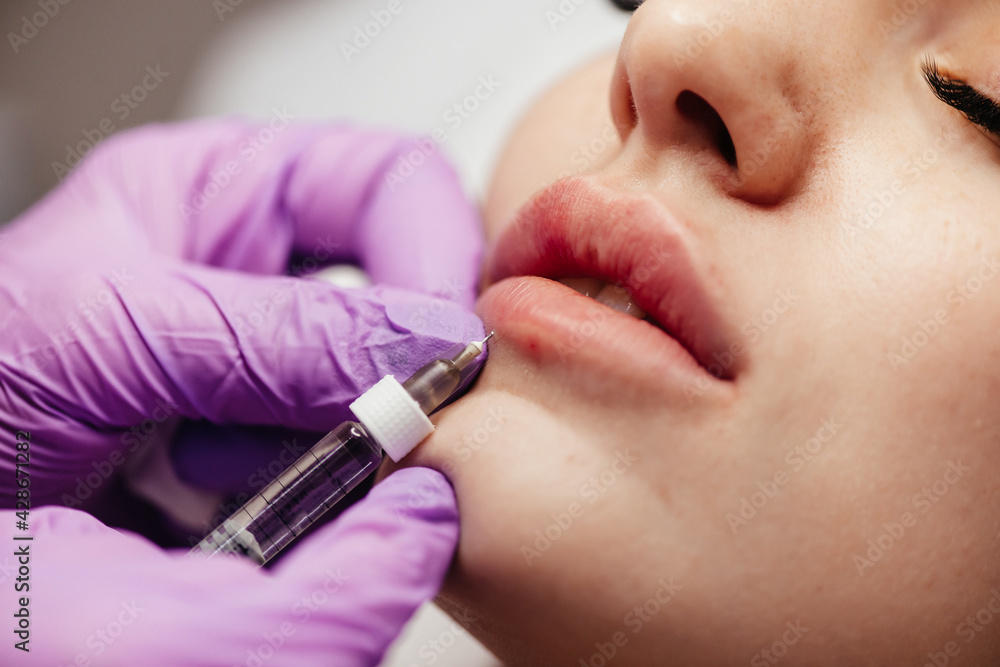 Young woman receiving a injection in her lips, close up