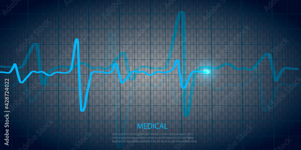 Cardiology concept with pulse rate diagram. Medical background with heart cardiogram. Cardiology concept with pulse rate diagram. Medical background with heart cardiogram.