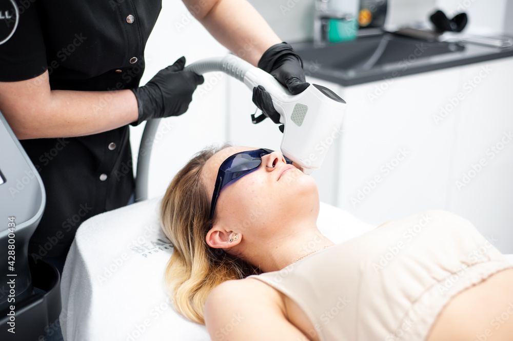 Laser face epilations procedure for woman Laser face epilations procedure for woman