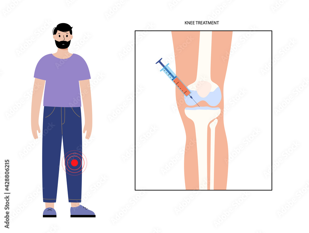 Fototapeta premium Knee Injection and treatment