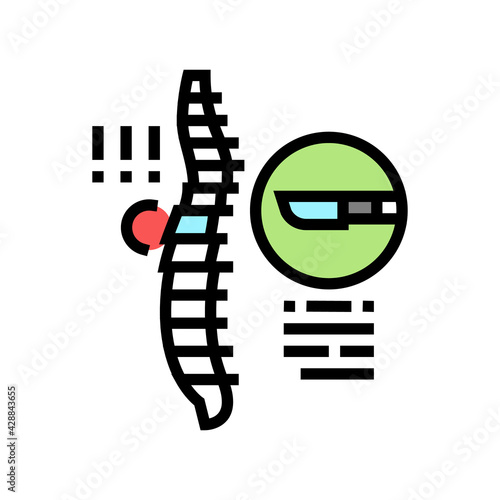 surgery scoliosis color icon vector. surgery scoliosis sign. isolated symbol illustration