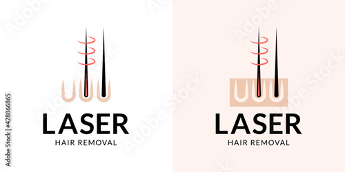 Laser hair removal logo