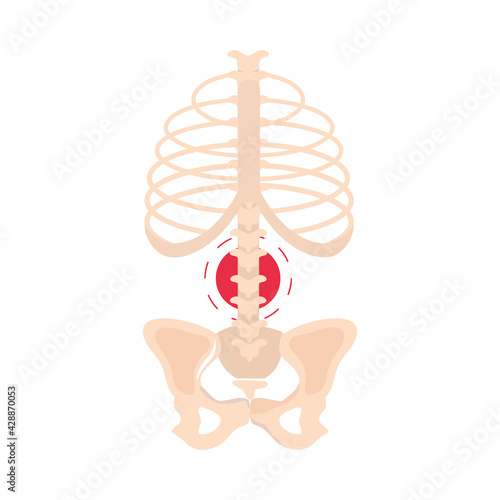 rheumatism spine joint