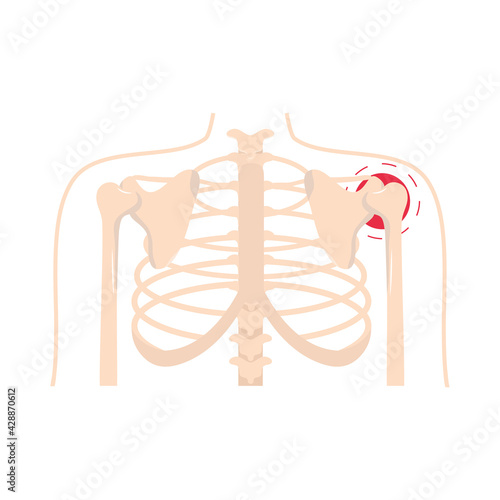 rheumatism shoulder pain