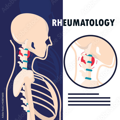 rheumatology human skeleton