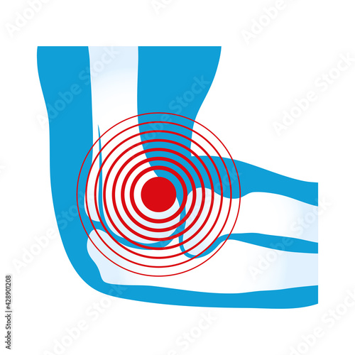 elbow rheumatological pain photo