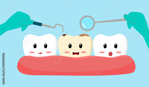 Dentist check up caries tooth with tool and mirror in flat design. Cute cartoon of cavity tooth. Dental clinic.