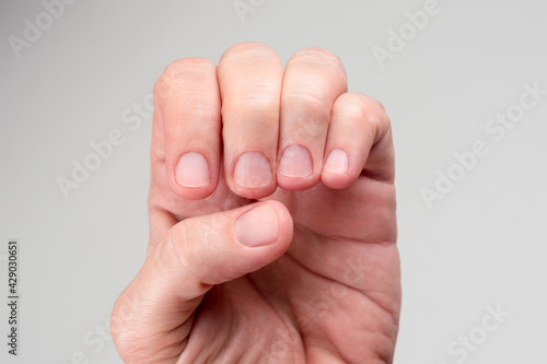 Healthy short nails after treatment. Clean short cutted nails after manicure. Beauty and skincare concept.