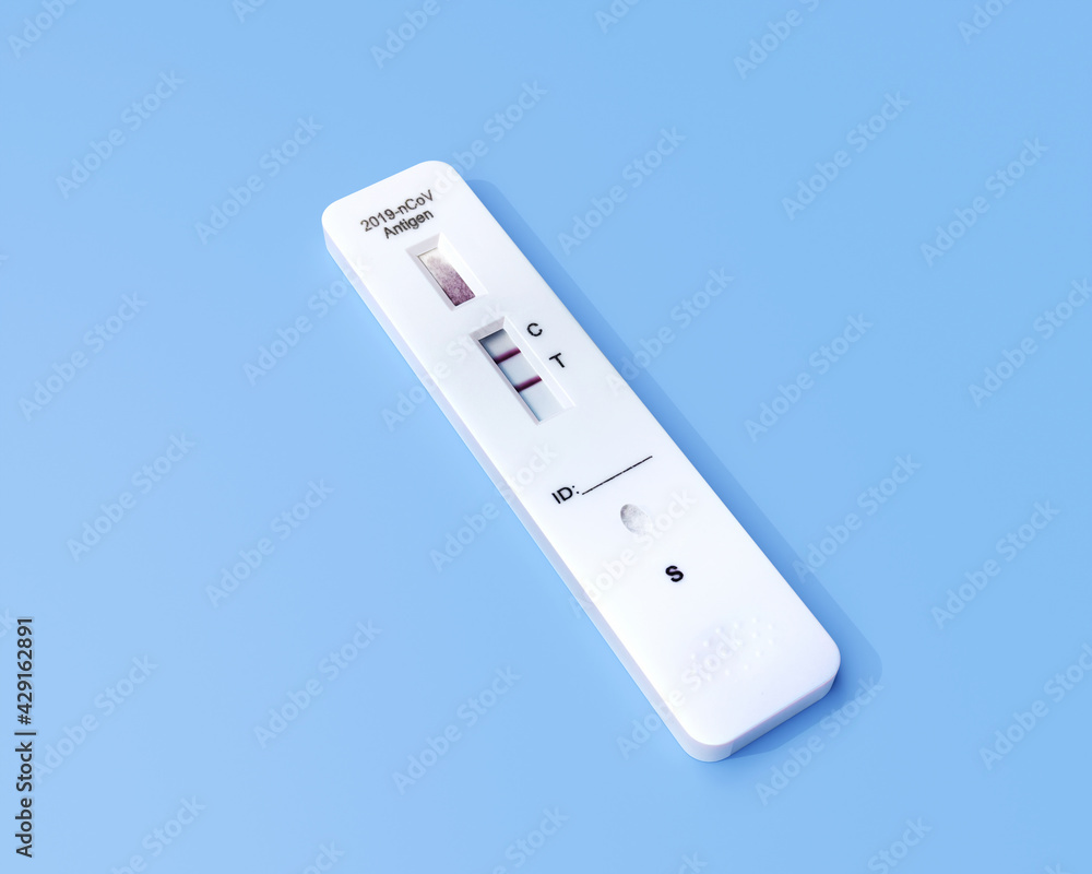 Positive Result for COVID-19 with test kit for viral disease COVID-19 2019-nCoV. Lab card kit test for coronavirus SARS-CoV-2 virus. Fast test COVID-19. Positive Result for COVID-19 with test kit for viral disease COVID-19 2019-nCoV. Lab card kit test for coronavirus SARS-CoV-2 virus. Fast test COVID-19.
