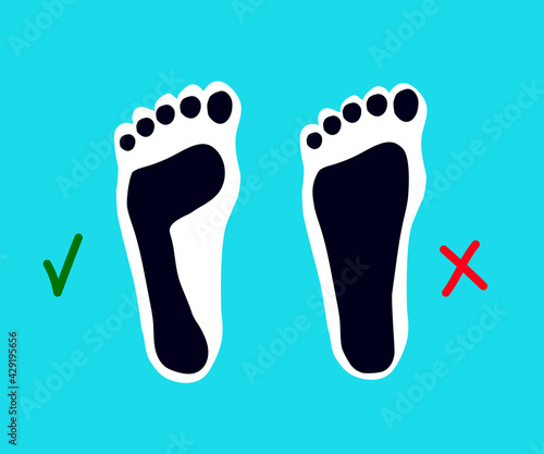 Human footprint. Flat feet. Symbol. Vector illustration.