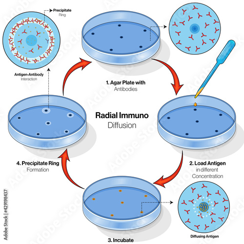 Radial Immuno diffusion experiment. 