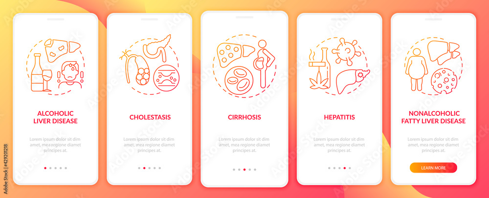 Liver dysfunction onboarding mobile app page screen with concepts. Cholestasis, alcoholic disease walkthrough 5 steps graphic instructions. UI, UX, GUI vector template with linear color illustrations