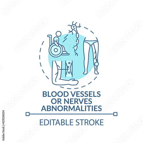 Blood vessels and nerves abnormalities concept icon. Amputation idea thin line illustration. Congenital abnormality. Long-term complication. Vector isolated outline RGB color drawing. Editable stroke