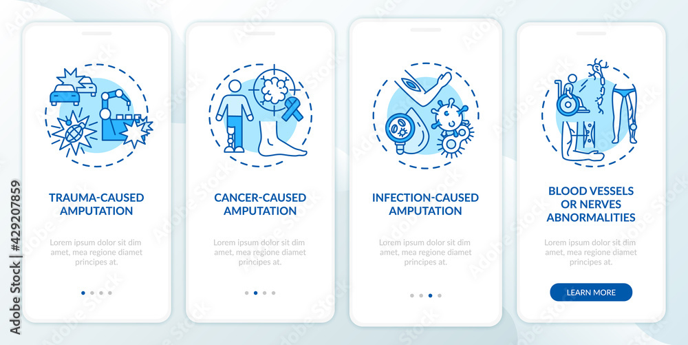 Amputation causes onboarding mobile app page screen with concepts. Tumor, blood vessels damage walkthrough 4 steps graphic instructions. UI, UX, GUI vector template with linear color illustrations