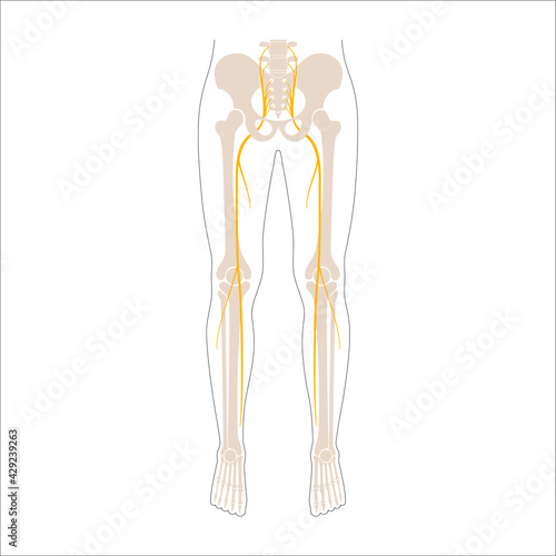 Sciatica pain concept
