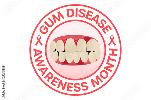 February gum disease awareness month vector illustration isolated on white background. Diagnosis, prevent, protection, and gingivitis concept.