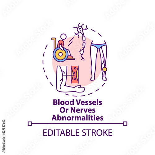 Blood vessels and nerves abnormalities concept icon. Amputation cause idea thin line illustration. Nerve damage. Normal blood flow absence. Vector isolated outline RGB color drawing. Editable stroke