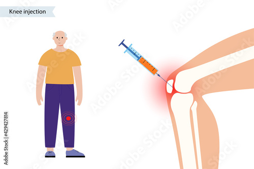 Knee Injection xray