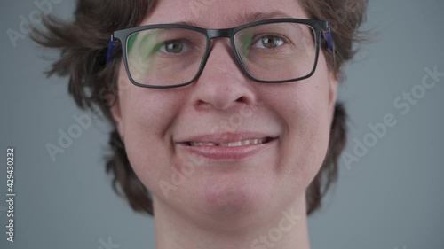 Smiling young caucasian woman with broken front tooth from which fiberglass pins sticking out. Tooth injury, chipped tooth half after accident. Dentistry and maxillofacial treatment. Dental trauma photo